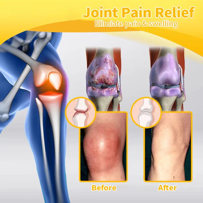 Flysmus™ Bee Venom Pain-Relief Bone Healing Cream(Specially for older adults & AOA recommends)🏆🐝